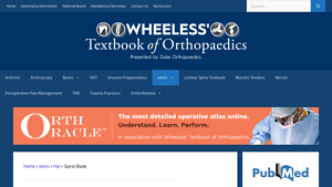 Wheeless Online - Spiral Blade